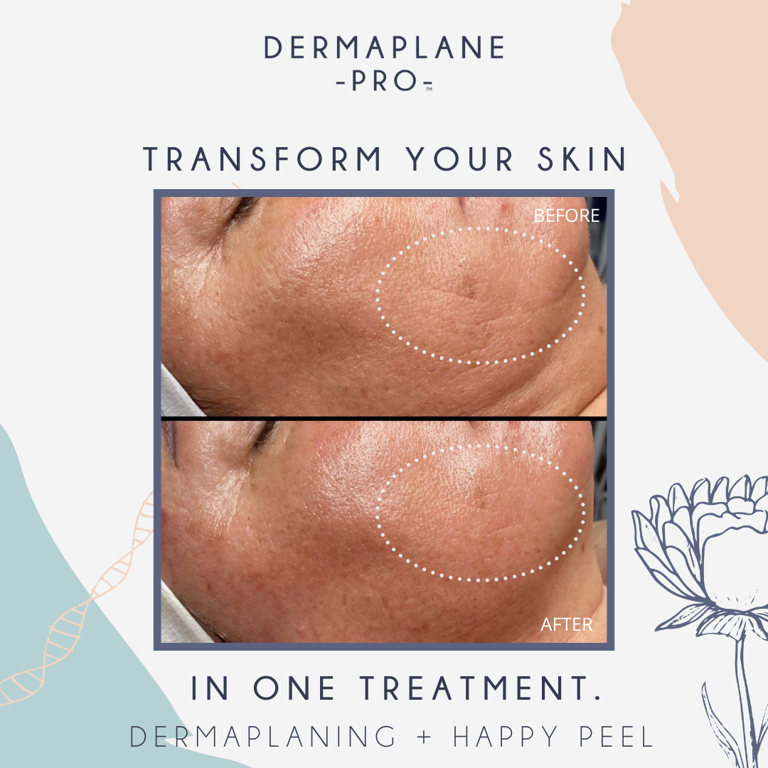 Ageless Dermaplane Facial