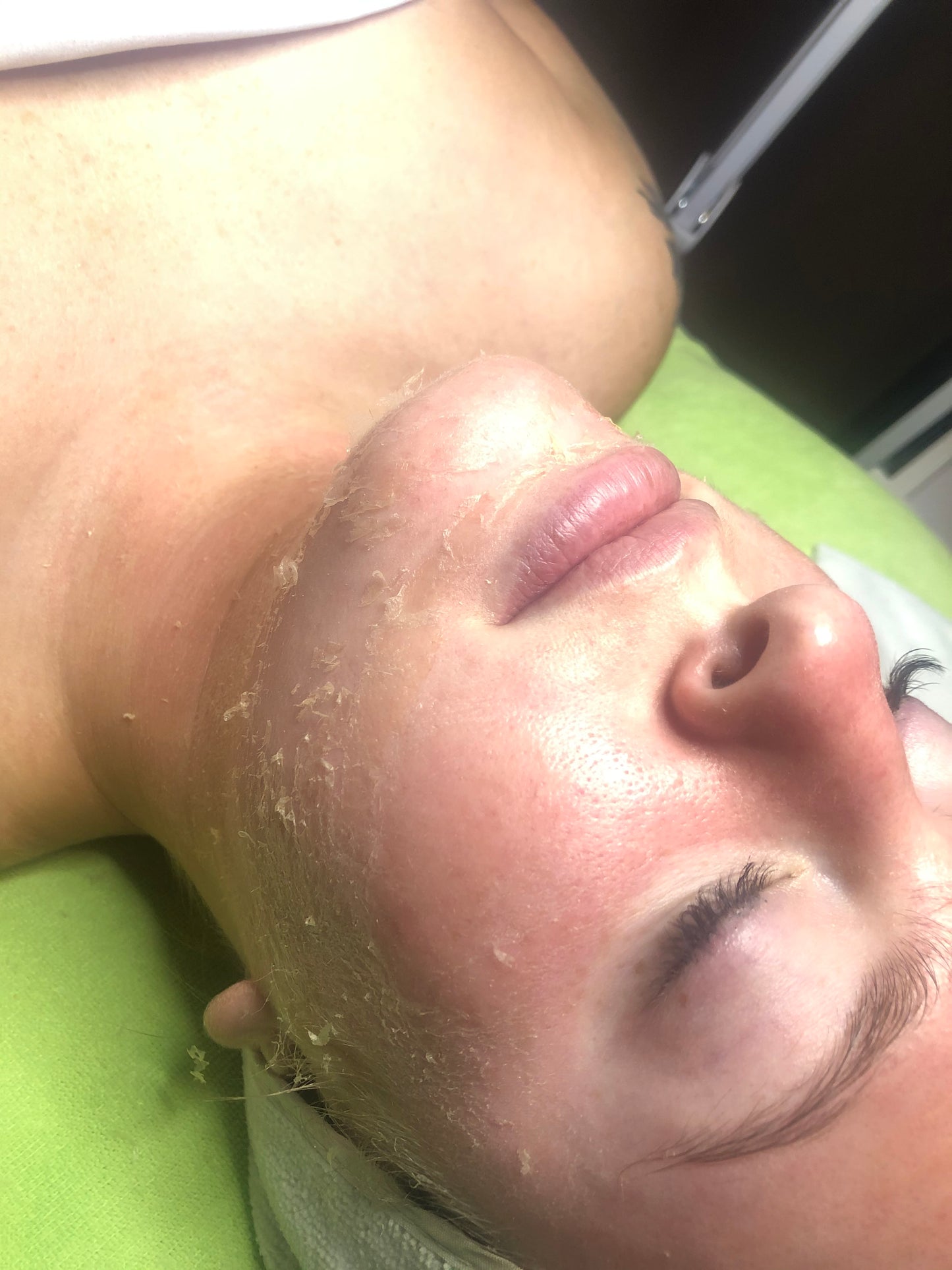 Exfoliate & Glow Facial